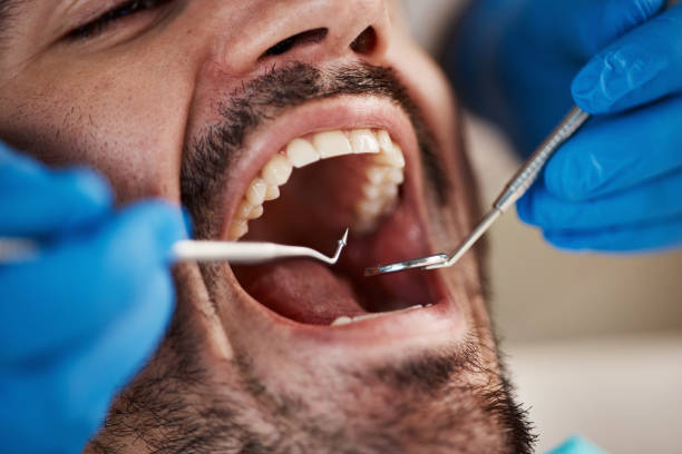 Best Emergency Treatment for Dental Infections or Abscesses in Spring Grove, MN